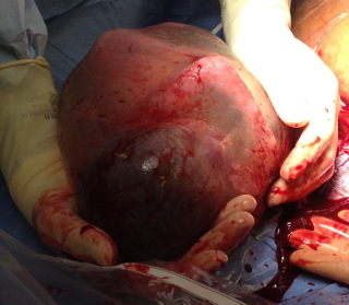 Illustration for article titled Rare Images Of A Baby Born While Still Inside The Amniotic Sac